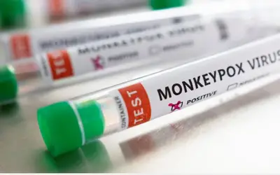 Varíola dos macacos: prefeitura confirma caso positivo da doença em Andradas